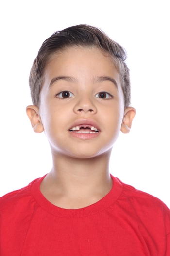 Abrahan Barros de Assis